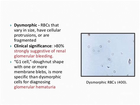 Leukocytes In Urine Normal Range