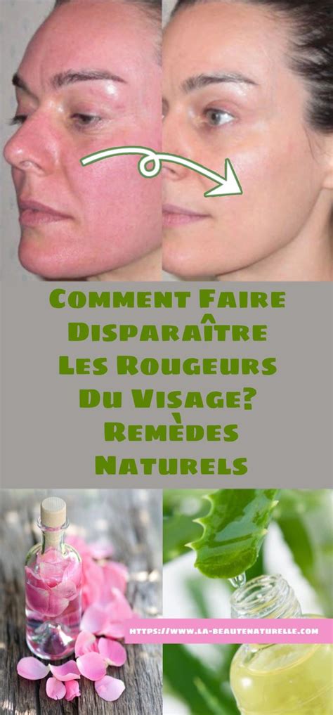 Comment Faire Dispara Tre Les Rougeurs Du Visage Rem Des Naturels