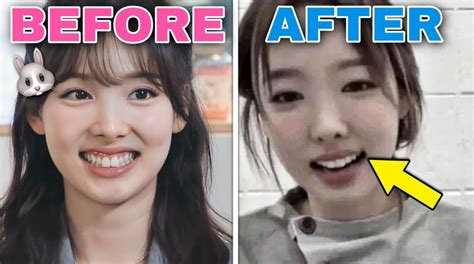 Netizens React To TWICE Nayeon S Trimmed Down Bunny Teeth Teeth