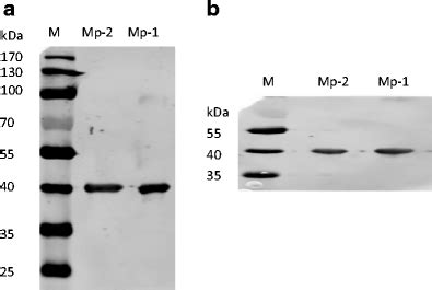 Western Blot Of Purified Mp 1 And Mp 2 Detected By Maspin A And