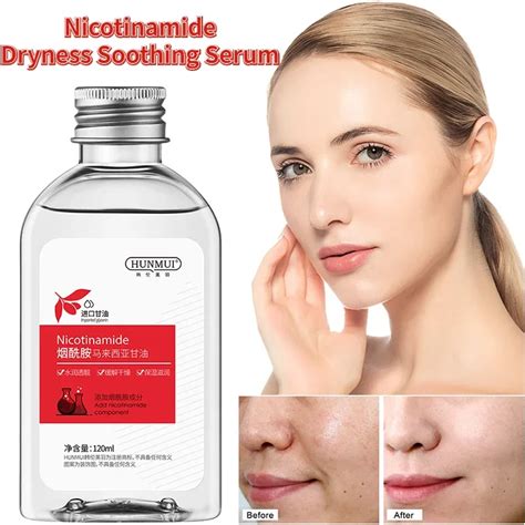 Niacinamide Malaysian Glycerin Liquid Brightens Skin Tone And Relieves