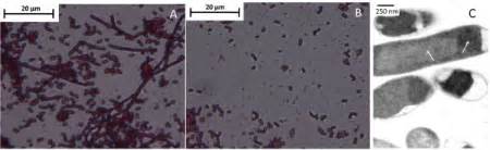 E Coli Cell Morphology Expressing Cbd Lunasin Light Microscopy Image