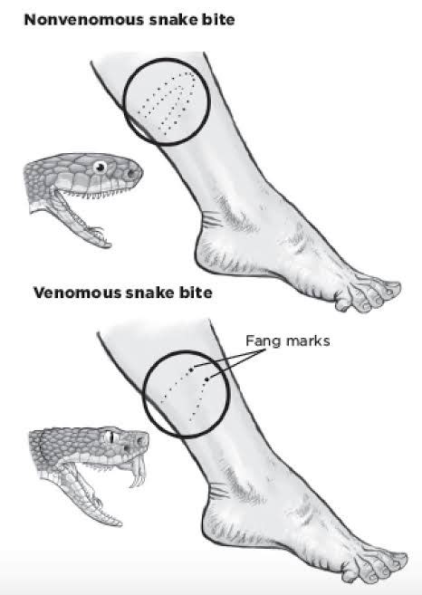 Difference Between Non-Venomous Snake Bite Vs Venomous Snake Bite! : r ...