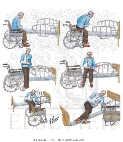 Transfer from Wheelchair to Bed After Stroke