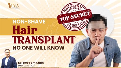 Fue Hair Transplant Without Shaving Head Non Shave Hair Transplant