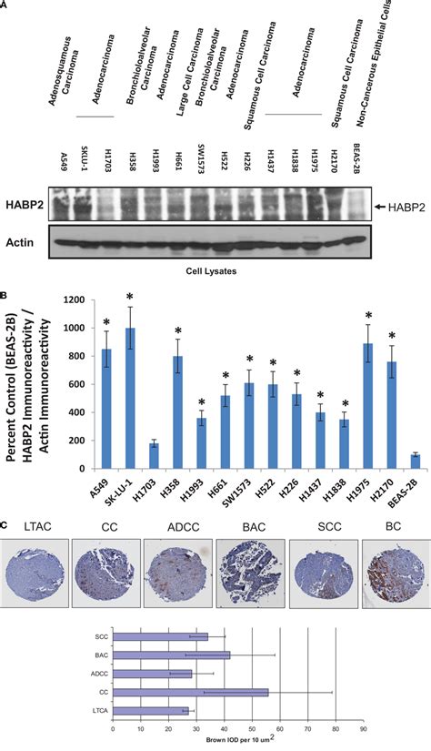 Hyaluronan Binding Protein 2 Is Upregulated In Several Human Nsclc Cell