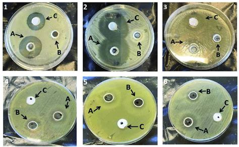 Inhibition Zone Diameters Caused By Various Formulations A Fa Neg