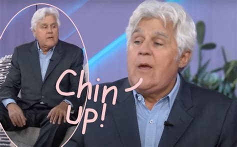 Jay Leno Shows Off Brand New Face Amid Recovery Months After Horrific