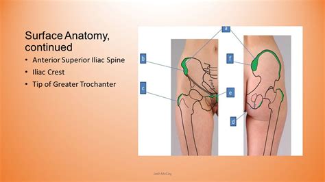 Iliac Tubercle Surface Anatomy