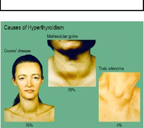 [pdf] Examination Of The Thyroid Gland And Thyroid Status Semantic