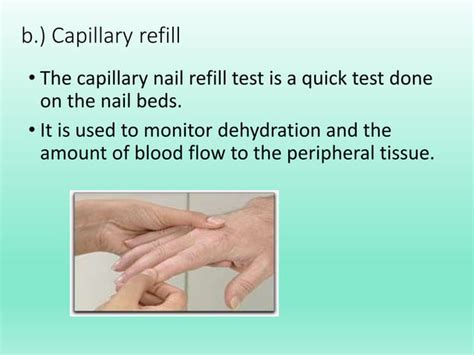 Neurovascular Assessment Ppt