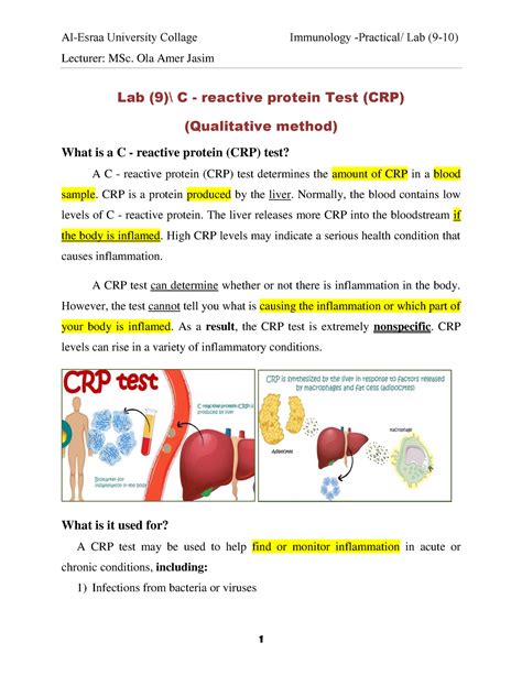 Lab 9 C Reactive Protein Test Crp Lecturer Msc Ola Amer Jasim Lab 9 C Reactive