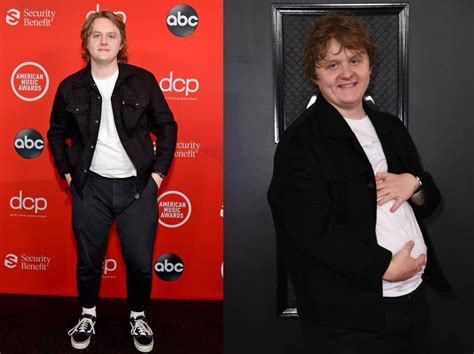 Lewis Capaldi Antes E Depois