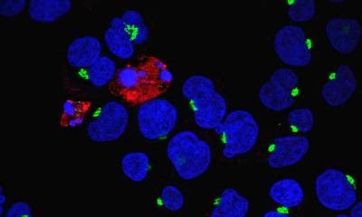 Study reveals vital physiological role of cell death and inflammation ...