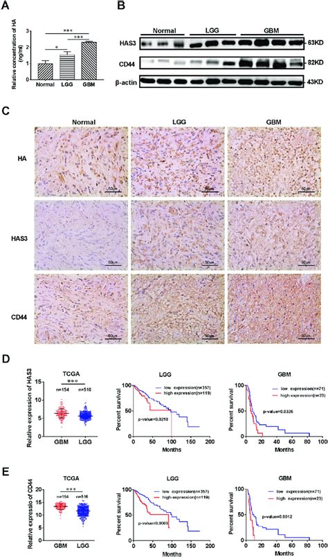 Hyaluronic Acid Has3 And Cd44 Are Increased In Glioma Tissues And