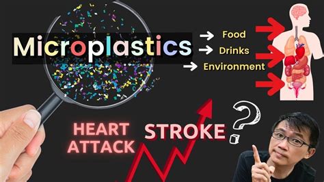 Microplastics Linked To Higher Risk Of Heart Attacks & Strokes - Dr ...