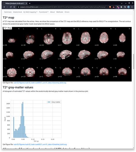 ENH Plot Histogram Of T2 Values In Gray Matter Mask By Effigies