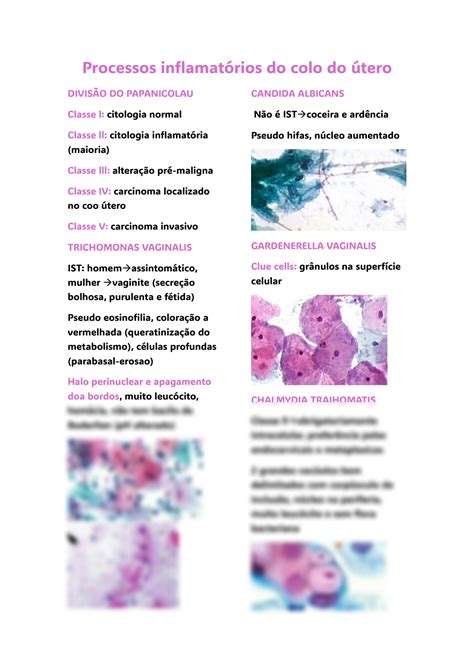 SOLUTION Processos Inflamat Rios Do Colo Do Tero Studypool