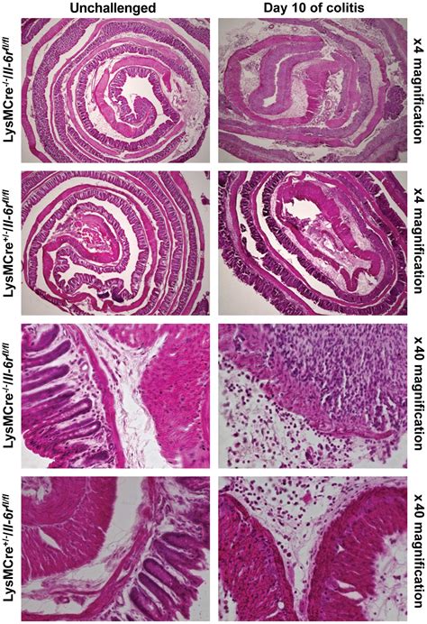 Interleukin 6 But Not The Interleukin 6 Receptor Plays A Role In Recovery From Dextran Sodium