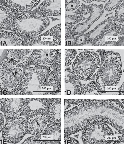 Photomicrographs Of Mice Testicular Cells Stained With Haematoxylin And