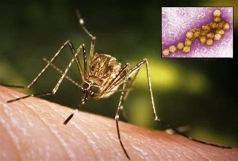 West Nile Virus Mosquitoes Treatment Symptoms And Diagnosis