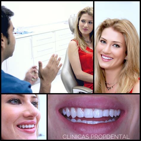 Testimonio Blanqueamiento Dental Cl Nicas Propdental