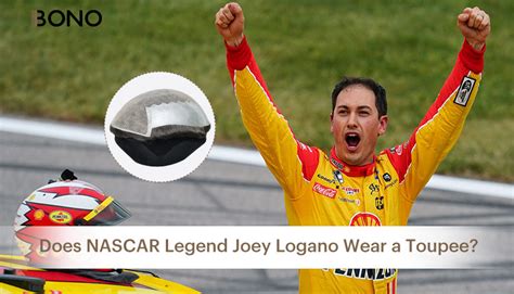 Does Joey Logano Wear a Toupee?