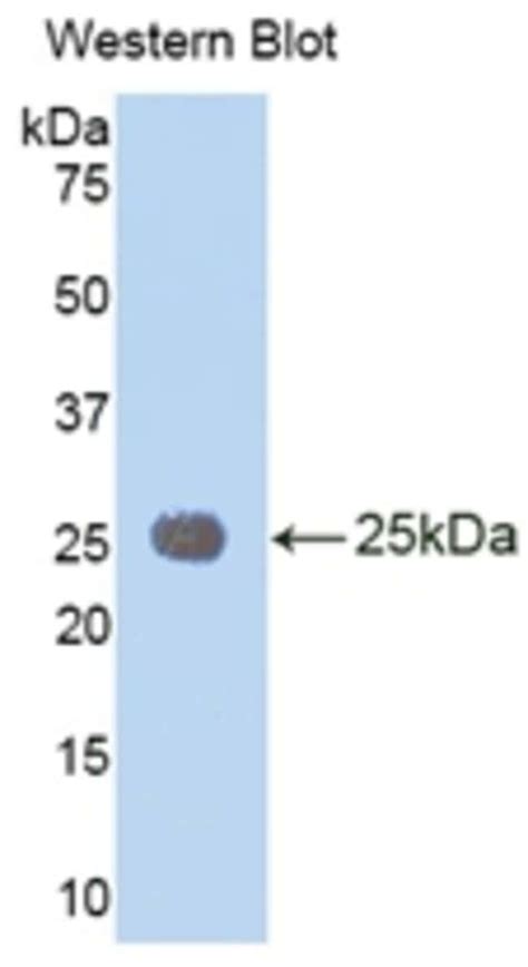 IL 1RAcP Polyclonal Antibody Invitrogen 20 μL Unconjugated Antibodies