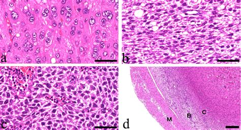 Histopathological findings. (a) Large epithelial-like decidual cells... | Download Scientific ...