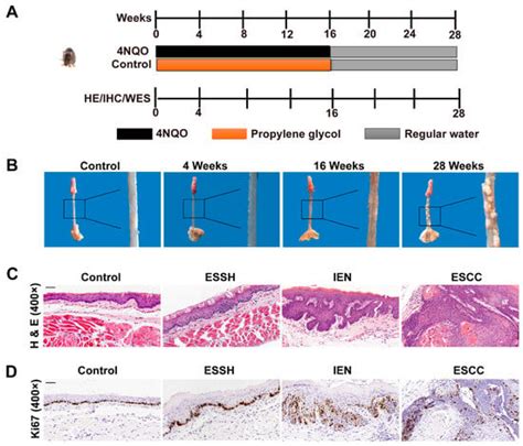 IJMS Free Full Text Esophageal Squamous Cancer From 4NQO Induced