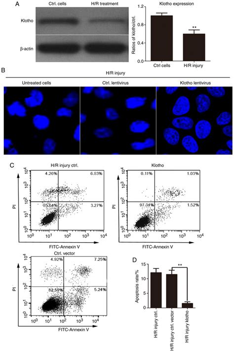 Klotho Overexpression Markedly Inhibits H R Induced Apoptosis In