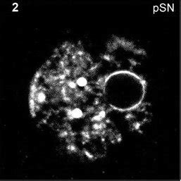 Double Immunofluorescence Of Oocytes Nuclei With Sc Ab Green And