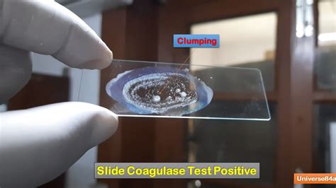 Slide Coagulase Test Introduction Principle Procedure Result Interpretat