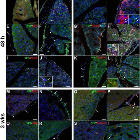 Wt1 Expression And Wt1 Lineage Cells In Adult Pancreas A Wt1 Cre