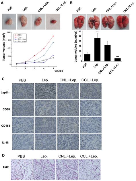 Effect Of Leptin And Macrophages On Organ Metastasis In The Nude Mouse