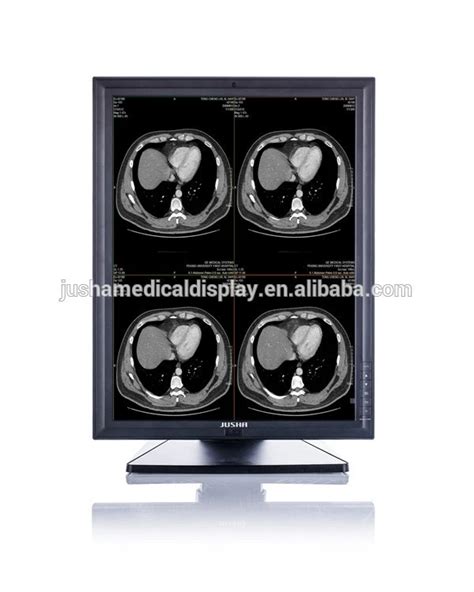 Buy Jusha M C Mp Medical Grade Monitor From Nanjing Jusha Display