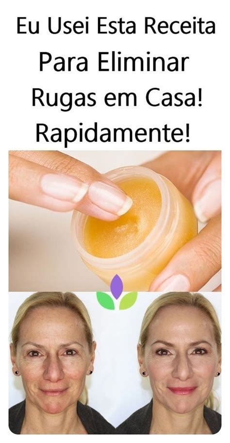 Receita Maizena Para Eliminar Rugas Rapidamente Rugas No Rosto