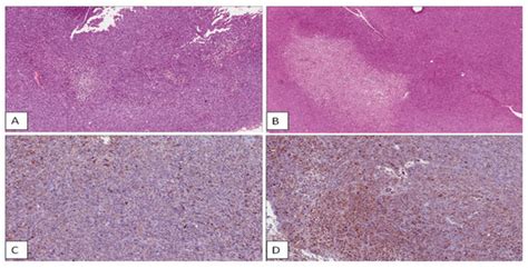 Ijms Free Full Text Molecular Investigation On A Triple Negative Breast Cancer Xenograft