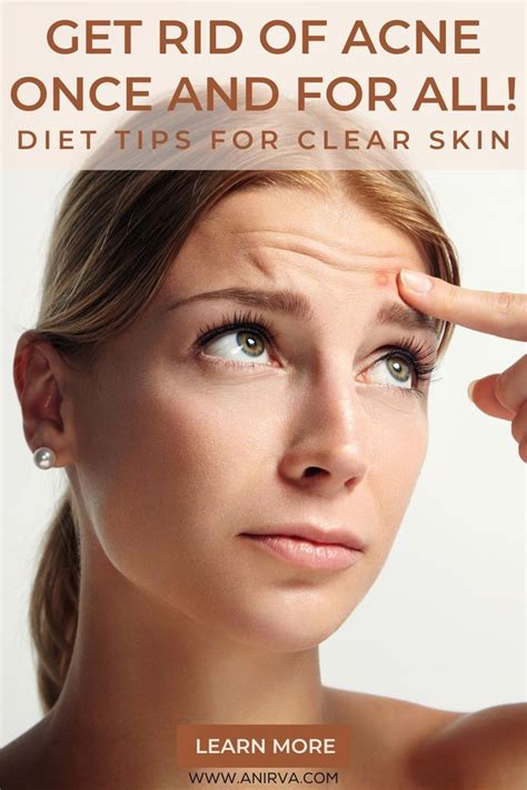 Get Rid Of Acne Once And For All How To Get Rid Of Acne Clear Skin Tips Acne