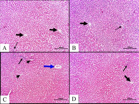 Photomicrographs Of Hematoxylin And Eosinstained Liver Sections