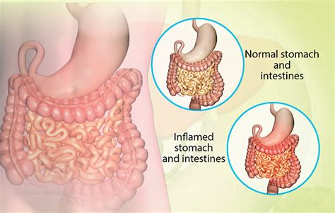 Health Symptoms : Causes, Treatment, Conditions and More
