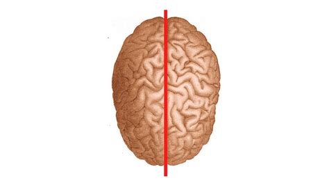 Left And Right Cerebral Hemispheres Corpus Callosum