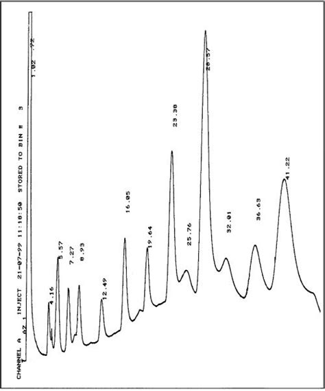 A Typical Chromatogram Of Kasar Cheese Samples Retention Times Are Download Scientific Diagram