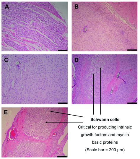 Histological Images Of Regenerated Sciatic Nerve Tissue In Groups A E