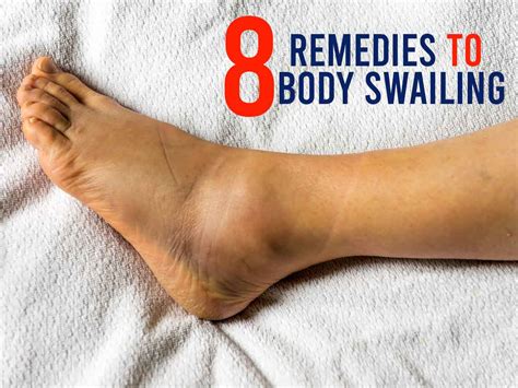 6 Home Remedies for Swollen Feet