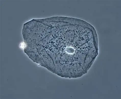 Phase Contrast Microscopy A Simple Explanation Microscope Clarity