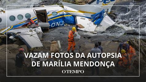 Fotos Da Autopsia Do Corpo De Mar Lia Mendon A Vazaram Nas Redes