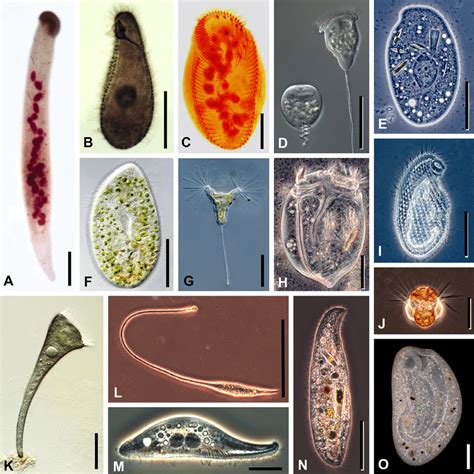 Photomicrographs Of Representative Ciliate Taxa Originals From D J