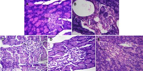 Histopathological Analysis Of Pancreas In Normal And Stz Nainduced