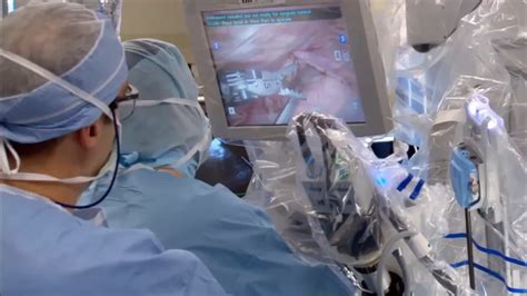 Exploring Robotic Hysterectomy The Davinci Hysterectomy Partial